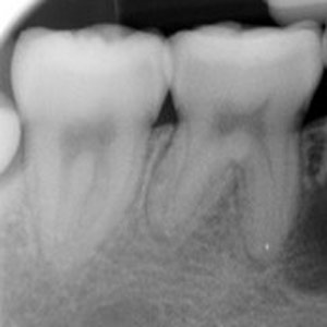 _45chloroform-technique